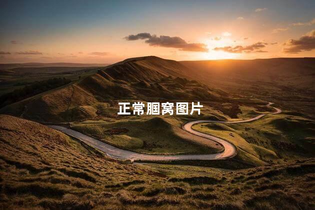 正常腘窝图片 正常腘窝图片