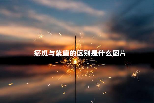 瘀斑与紫癜的区别是什么图片 瘀斑与紫癜的区别是什么图片