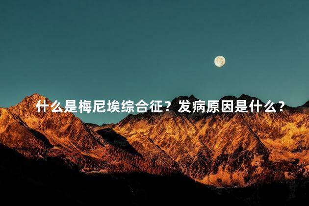 什么是梅尼埃综合征？发病原因是什么？要怎么治疗？