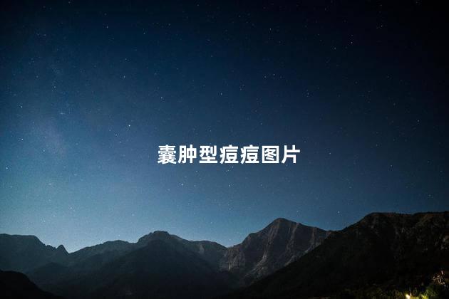囊肿型痘痘图片