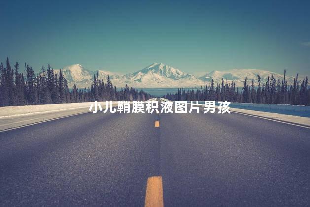小儿鞘膜积液图片男孩