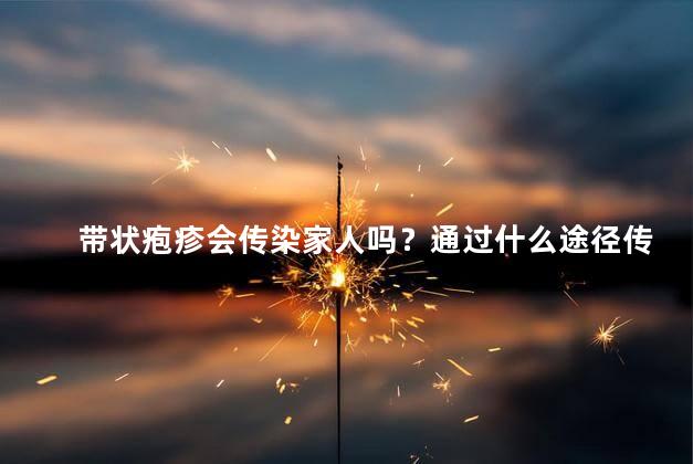 带状疱疹会传染家人吗？通过什么途径传染？