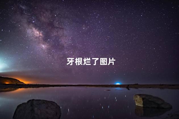 牙根烂了图片