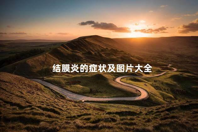 结膜炎的症状及图片大全