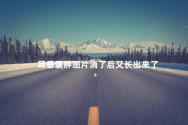 耳垂囊肿图片消了后又长出来了